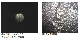 鮮明な画像 IPLEX TX φ2.4mm